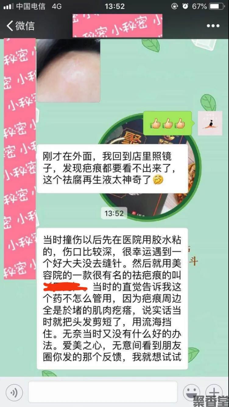 祛腐zais(图7) 祛腐zais(图7)