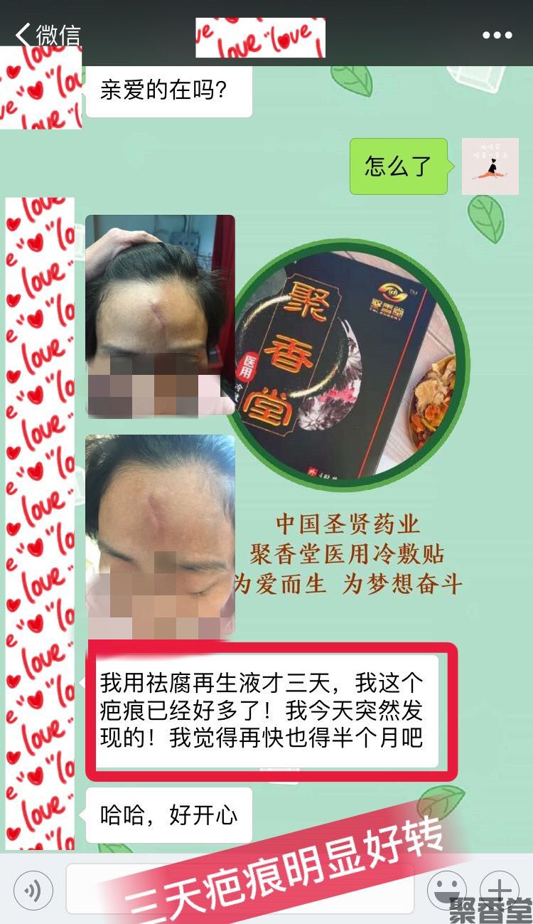祛腐zais(图4) 祛腐zais(图4)