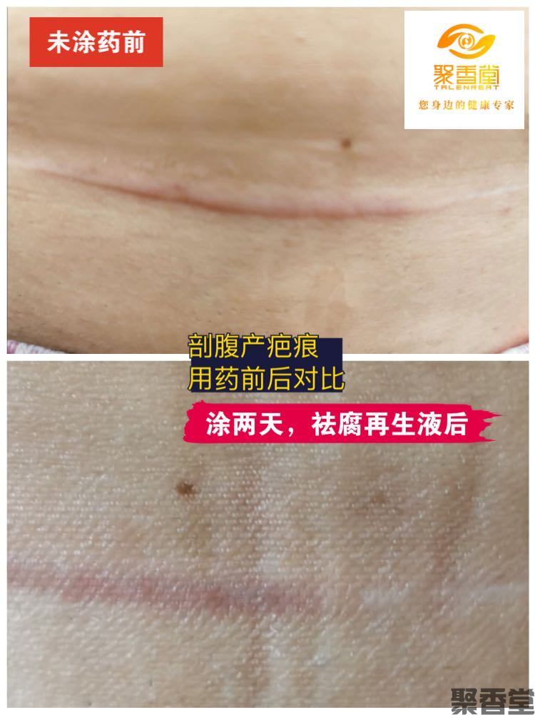 祛腐zais(图8) 祛腐zais(图8)