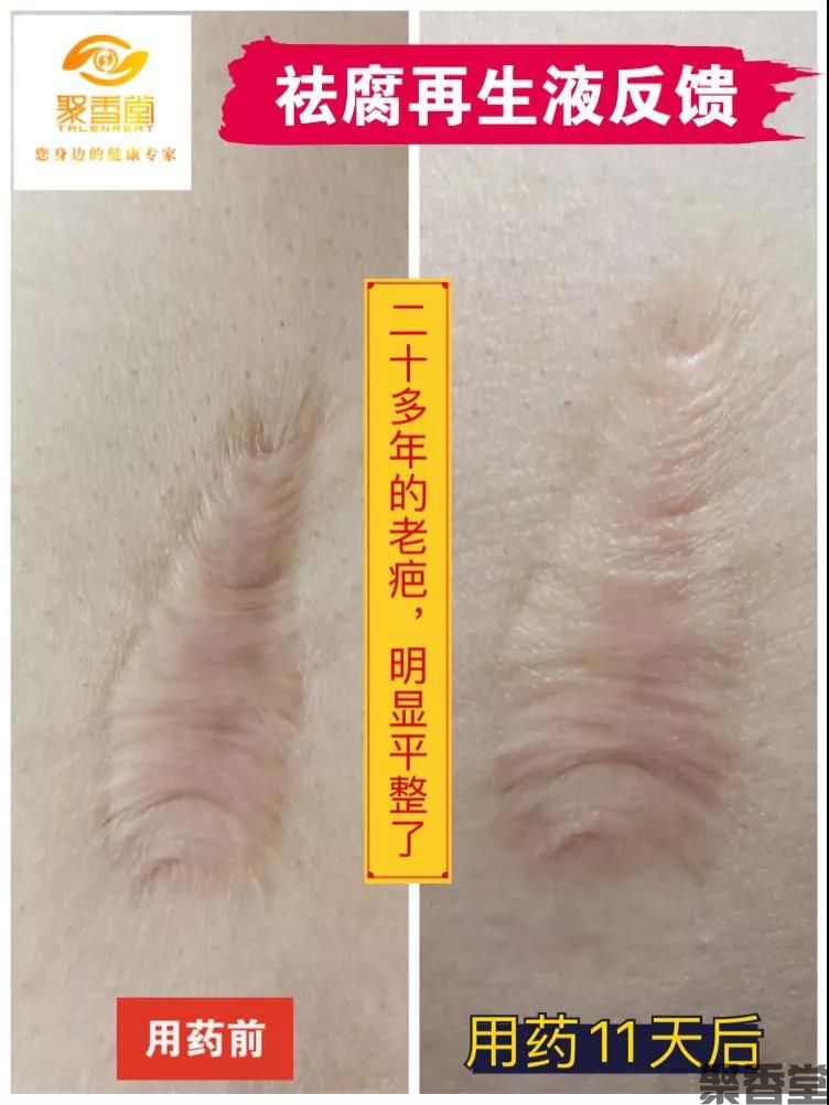 祛腐zais(图9) 祛腐zais(图9)