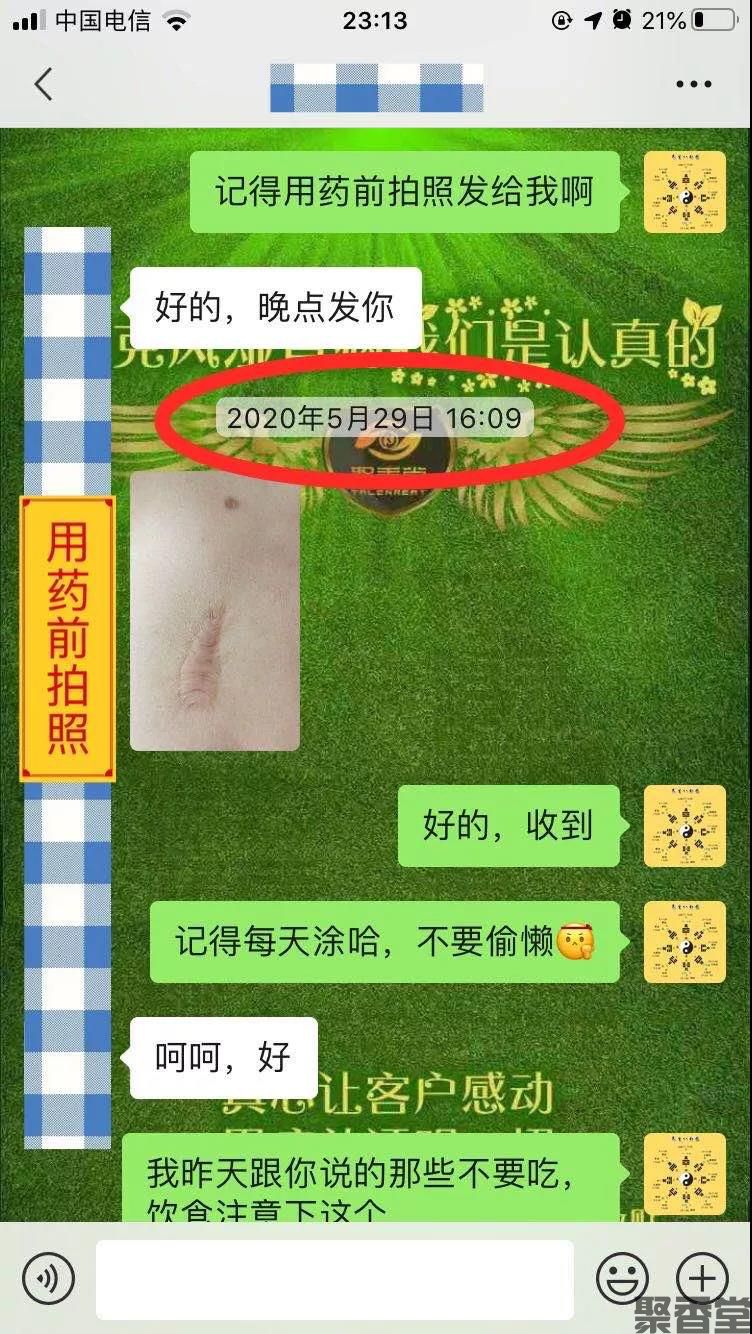 祛腐zais(图10) 祛腐zais(图10)