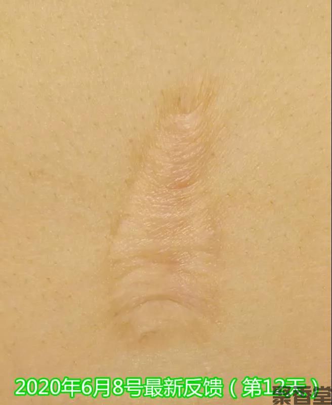 祛腐zais(图14) 祛腐zais(图14)