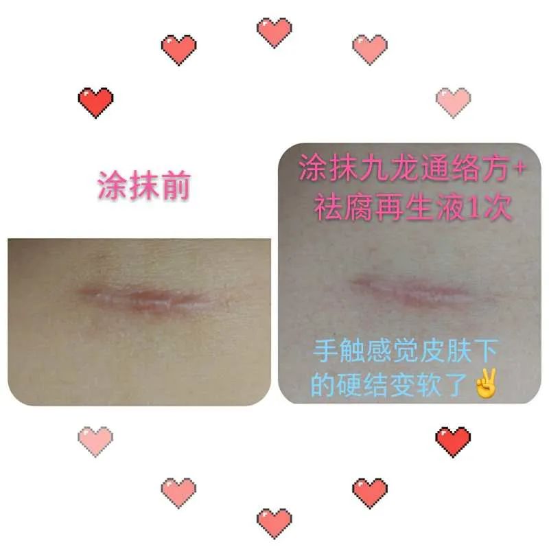 【祛腐再生液】系列反馈【图片】(图30)