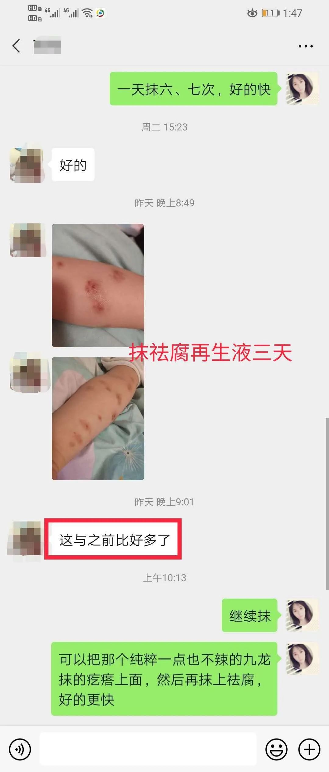 【祛腐再生液】系列反馈【图片】(图31)