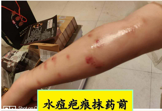 【祛腐再生液】系列反馈【图片】(图32)