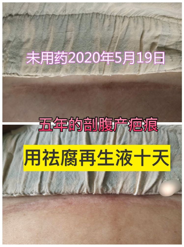 【祛腐再生液】系列反馈【图片】(图35)