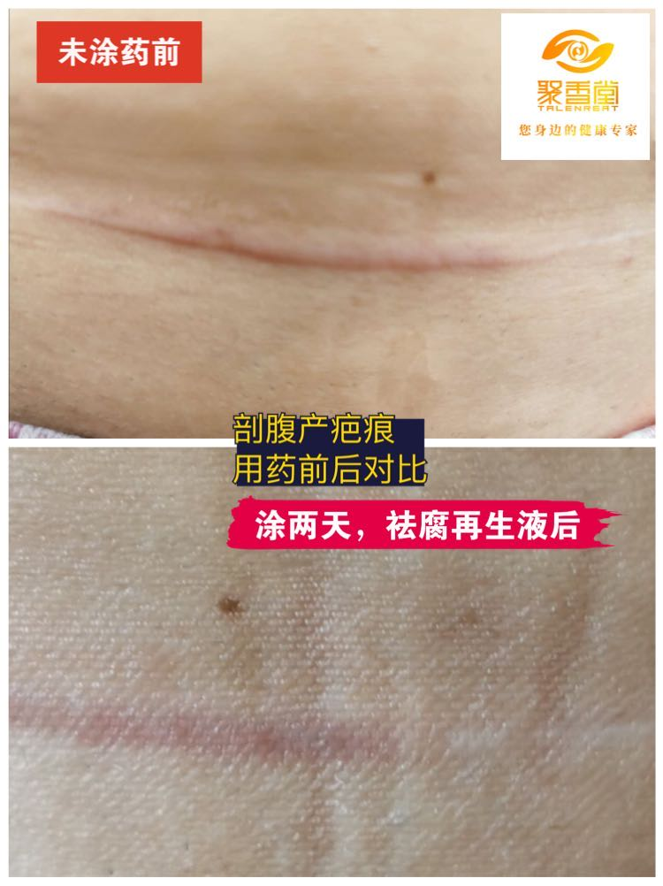 【祛腐再生液】系列反馈【图片】(图8)