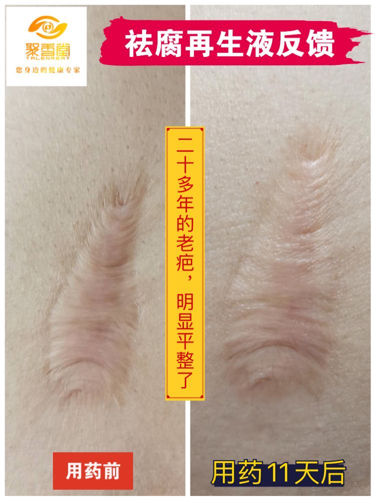 【祛腐再生液】系列反馈【图片】(图9)