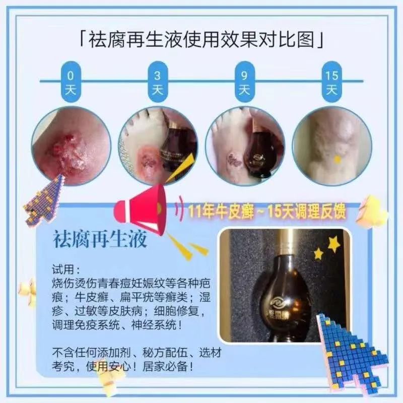【祛腐再生液】系列反馈【图片】(图15)