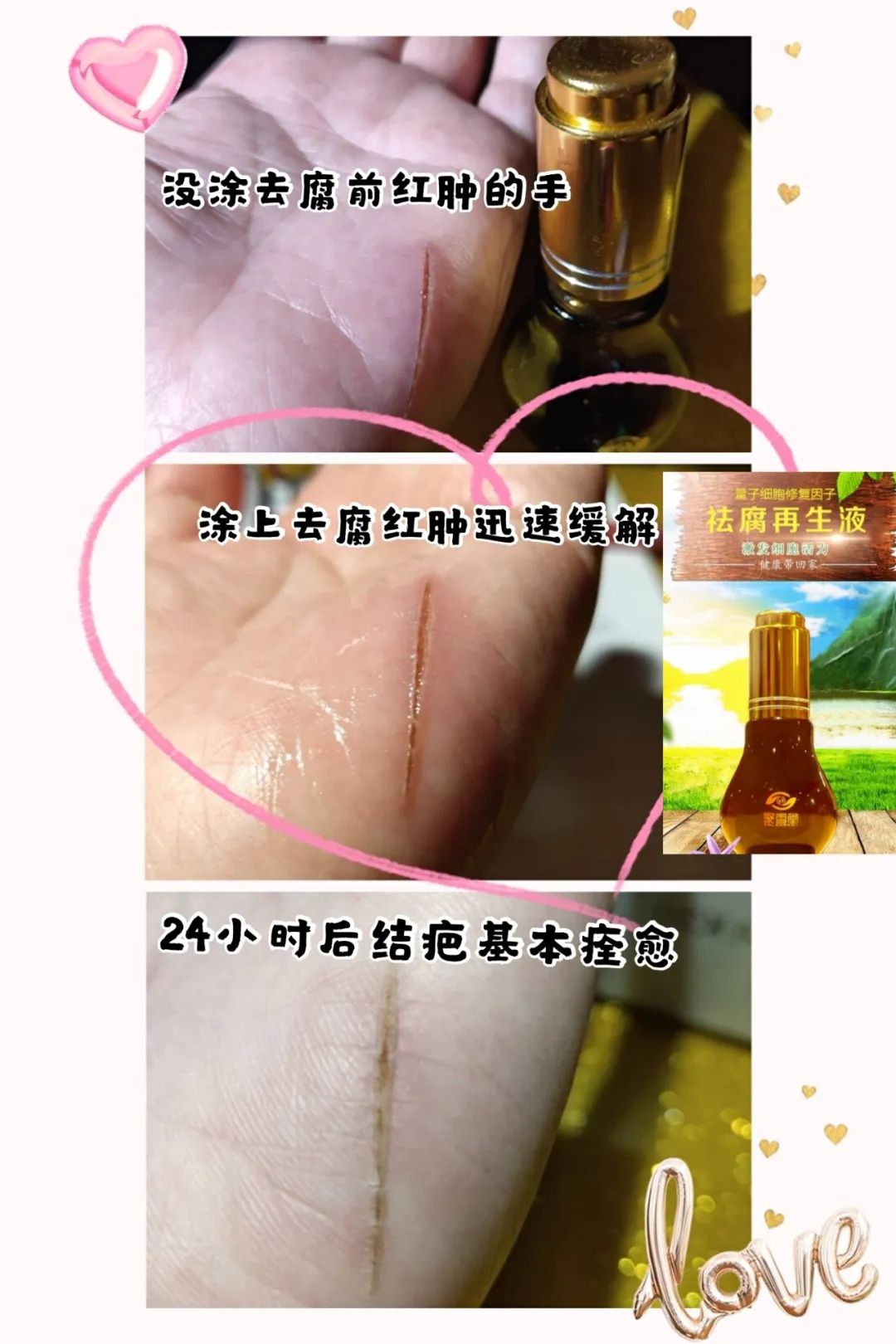 【祛腐再生液】系列反馈【图片】(图21)
