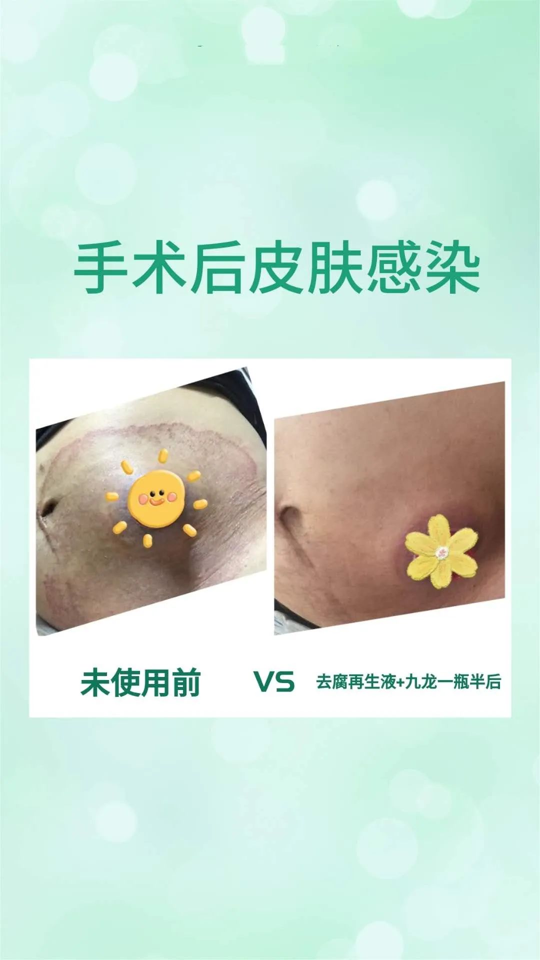 【祛腐再生液】系列反馈【图片】(图27)